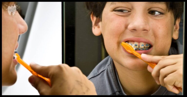 Best Step-by-Step Guide On How To Clean Braces For Beginners