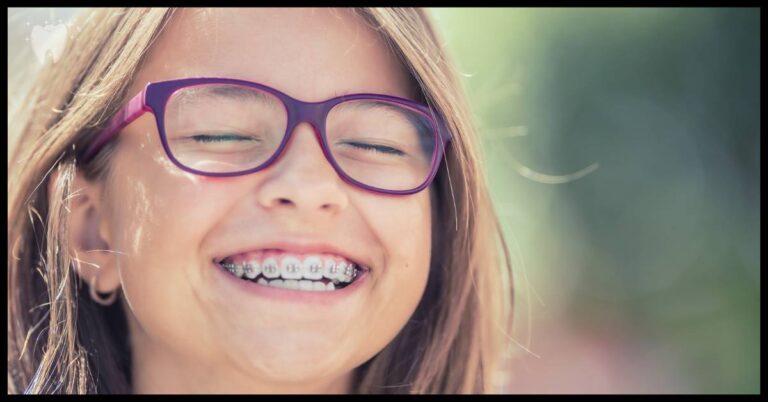 What Color Braces Are Best For Yellow Teeth To Make Them Whiter?