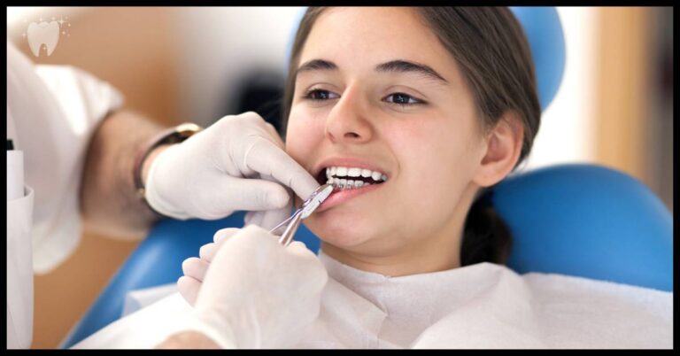 when should kids get braces