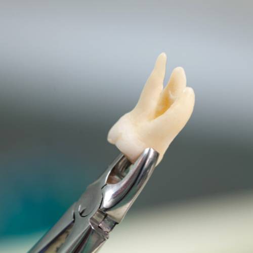 Your Journey to Dental Wellbeing Begins at ACDCDental.org 30 wisdom tooth